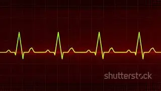 Master Heart Sounds in Minutes