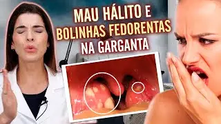 ACABE com as Bolinhas Fedorentas da Garganta e o MAU H&Aacute;LITO