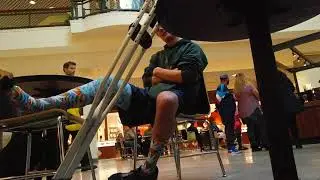 Grant's busted leg story