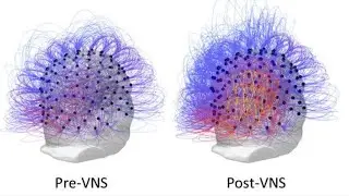 Vegetative-state patient responds to therapy