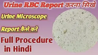 Urine Routine का रिपोर्ट कैसे करे | RBC कैसे पहचाने | Urine RBC under microscope
