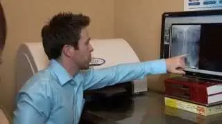 Kelowna Chiropractic BC Canada serving the Okanagan