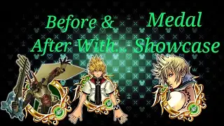 KH Union X -Before & After- Lingering Will And Illus. Roxas (EX Art Roxas Showcase)
