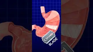 Stomach Vs Razor Blade