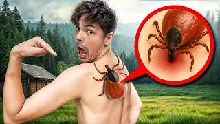 UGRYZŁ MNIE NAJWIĘKSZY KLESZCZ ŚWIATA!