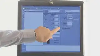 LOGIQ e9 logiq scan assistant