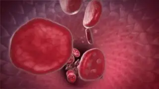New Method to Detect Heart Disease in RA Patients