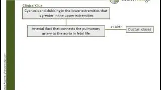 Internal Medicine ABIM Board Exam Review Question: Patent Ductus Arteriosus