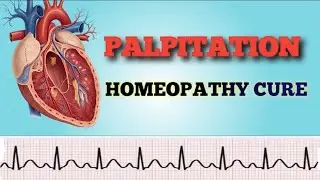 How to Stop Heart Palpitations Naturally | Effective Homeopathy #health #heart # anxiety #tachycardi