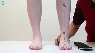 Sennofit, the most advanced AI insole in the world