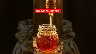 5 foods to Heal stomach ulcer 😇 #shorts #stomach #ulcers #youtubeshorts #food #health