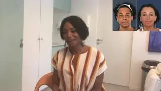 Facial Feminization Surgery Review - Isis, Dr Bart van de Ven reviews