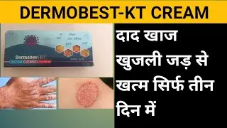 Dermobest-KT cream uses,full review in hindi.uses,doses,composition