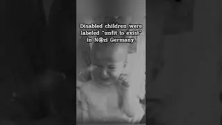 Doctors Legally K**led Disabled Children. #history#dark#baby#disability#ethics#medical#crime#fyp