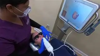 Introducing the iTero- Our 3D digital impression scanner!