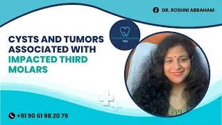 Cysts and Tumors Associated With Impacted Third Molars - Dr. Roshini Abraham