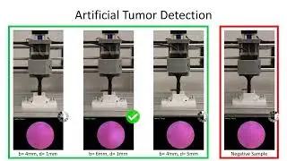 Miniaturized Vision-Based Tactile Sensing for Surgical Palpation | TacScope Demo