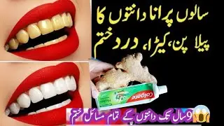 This recipe will make your yellow dirty teeth shine like pearls for 90 years /Teeth whitening remedy