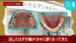 ［動画版］「治したはずの歯が次々に悪くなってきた」セラミック症例