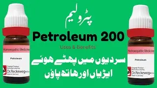 Petroleum 200 Uses & benefits | Cracked heels and hands in winter | Homeopathic Medicine 