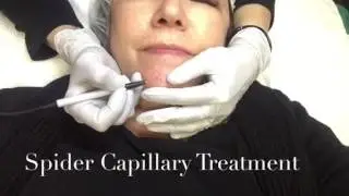 ThermoClear by Face Perfection