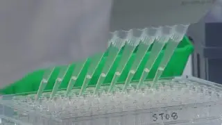 Rochester doctor explains third HIV cure, future treatment