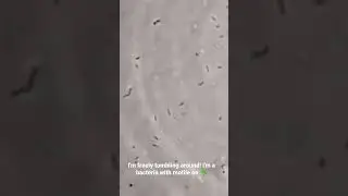 Motile Bacteria. Positive Motility in Wet Mount Microscopic Examination