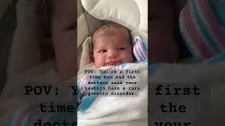 After birth story ❤️ #rare #love #shorts #couple #postpartum #parenting #momlife