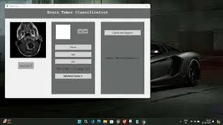 Project Node @ IEEE and NON IEEE Projects || Machine Learning || Computer Vision || Deep Learning
