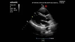 Wisonic Ec&oacute;grafo Clover Ultrasonido Port&aacute;til Cardiac 1- Diagn&oacute;stico M&eacute;dico