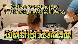 Motion Acupuncture for neck pain & stiffness