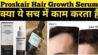 proskire hair growth serum review | proskire hair growth serum honest review