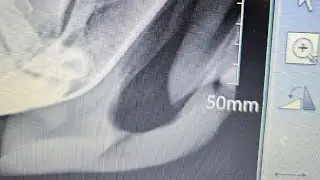 Broken Jaw On A Young Horse, Will It Heal~ Horse Poor #horse #recoveryjourney
