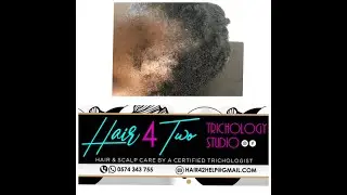 Hair 4 Two Trichology Studio: Hair Loss/ Hair Growth