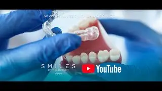 How does Invisalign work?