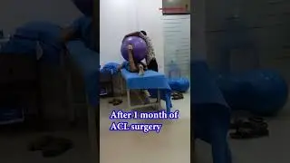 After 1 Month of ACL Surgery || ACL Surgery After 1 Month || Dr. Sandeep Singh