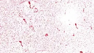 Cholera & Vibrio cholerae: Risks from Contaminated Environments, Food & Water