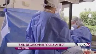 Skin Decision: Before and After