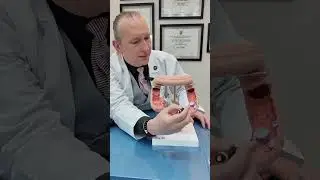 MIRA C&Oacute;MO SE VE UN P&Oacute;LIPO