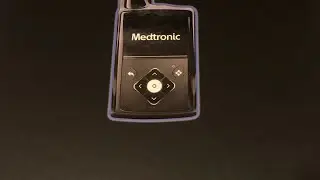 Medtronic Minimed 770G Week 1 Update