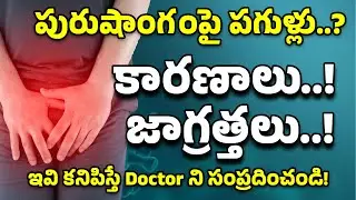 Penile Infections: Cracks, Redness & White Discharge Explained | Neogenetic Homeopathy