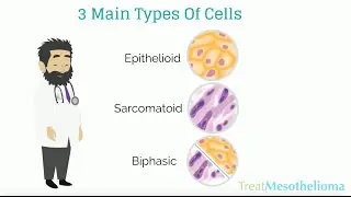 Mesothelioma Cell Types: TreatMesothelioma.org