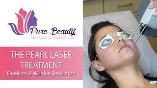 Laser Skin Tightening in Orange County by Pure Beauty Skin Care and Medical Spa