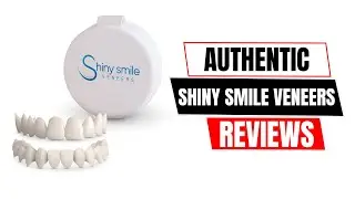 Shiny Smile Veneers Test &ndash; Fit, Comfort & Look After 1 Month!