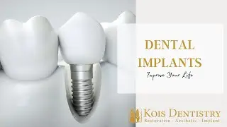3 Ways Dental Implants Can Help You Live a Better Life