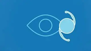 The Only Trifocal IOL in the USA for Cataract Surgery