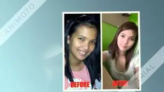 DR ALVIN SKIN CARE FROM ACNE TO CLEAR SKIN IN 4 WEEKS