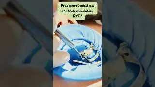 Does your dentist use a rubber dam during RCT? #dentalreels #mobiledentistry #duerrdental#viralreels