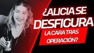 ¿SI SE OPERÓ LA CARA ALICIA VILLARREAL?📱