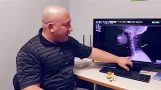 High Definition X-Ray at Hamilton Mill Family Complete Care